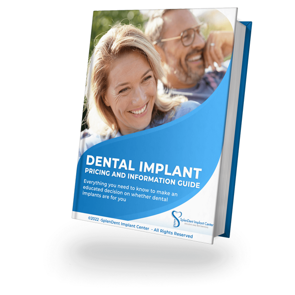 dental implants pricing guide book